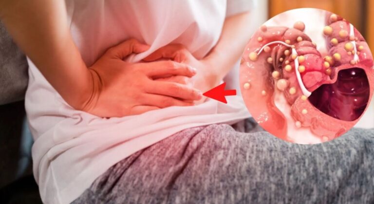 Especialista advierte sobre incidencia del cáncer de colon en RD