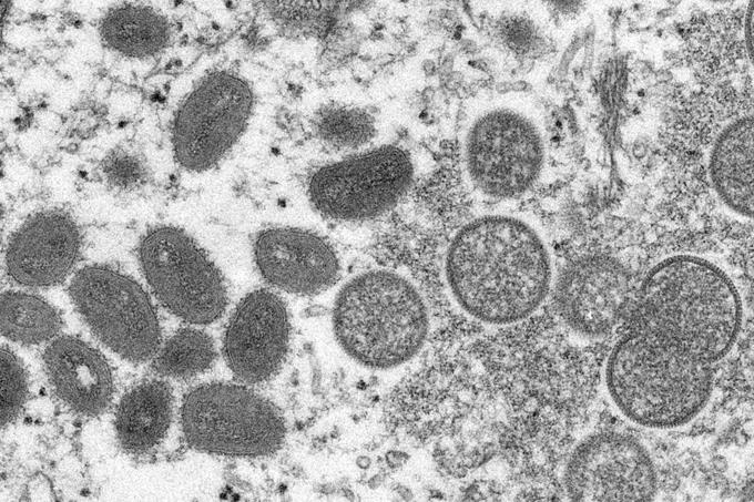 OMS convoca panel de expertos sobre viruela símica