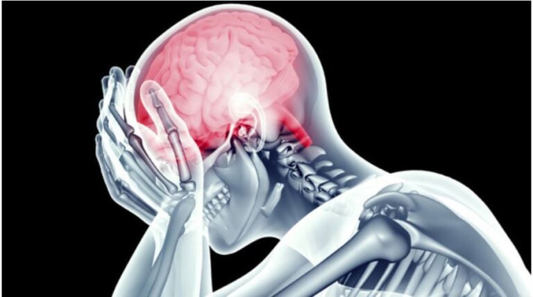 La Organización Mundial del Ataque Cerebral lanza juego para detención de accidente cerebral