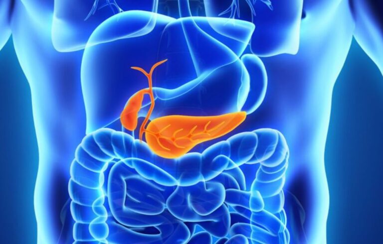 Por qué el cáncer de páncreas es el más difícil de prevenir y diagnosticar
